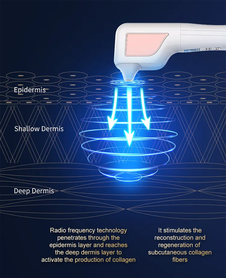 Skin Resurface Device 7