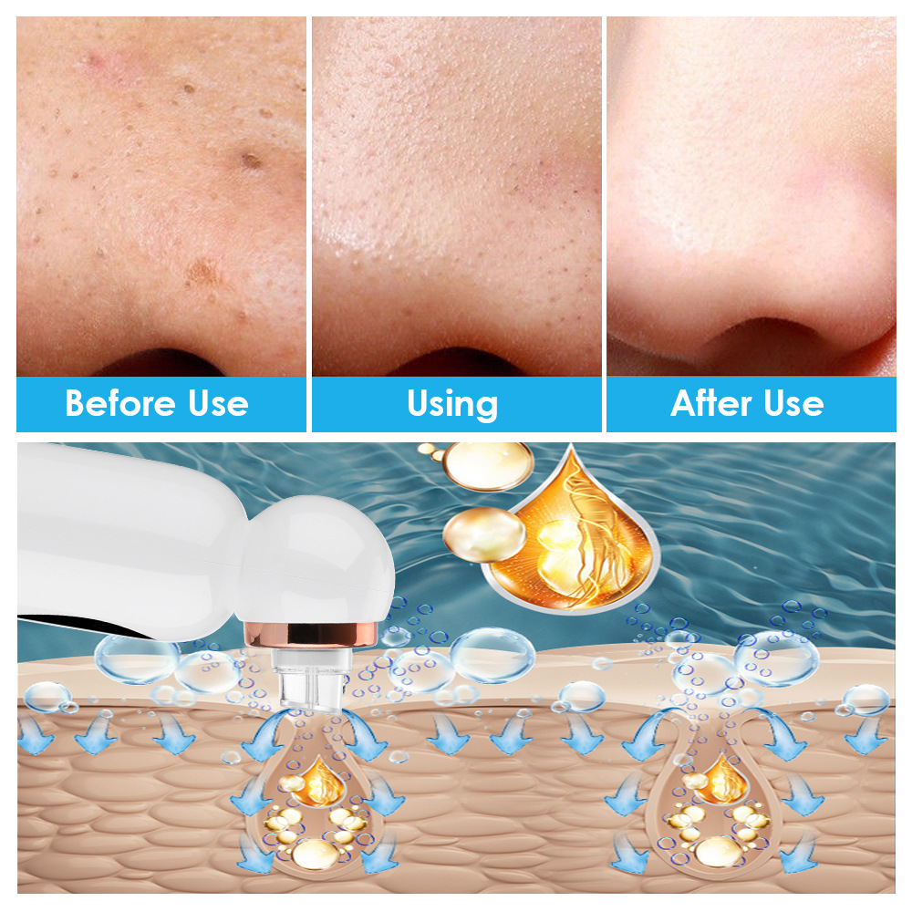 Small Bubble Home Use Handheld Skin Care Vacuum Pore Cleaner for Face Strong Suction Power Blackheads Removal Machine