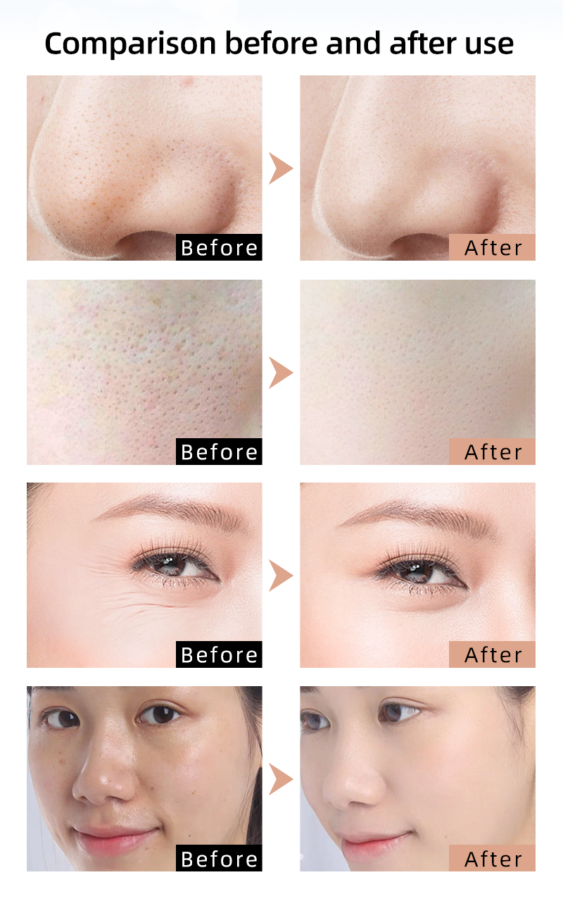 Led facial mask 6