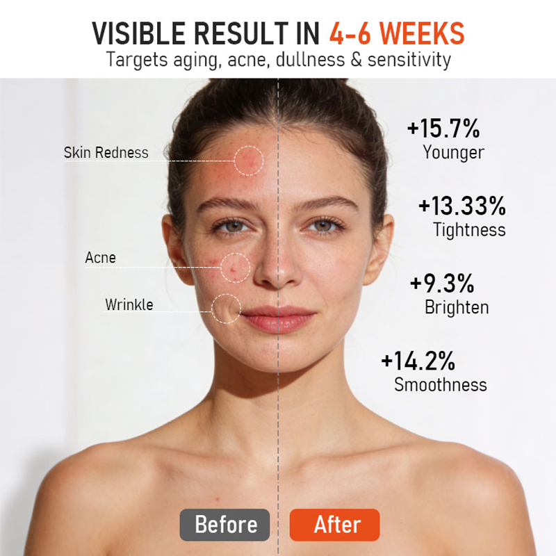 Portable Home Use LED Light Therapy Mask with 630nm Red Light 850nm Infrared Light for Acne Removal &amp; Wrinkle Reduction