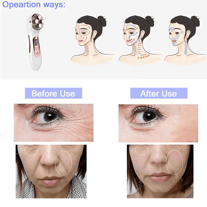 Wholesale High Quality Facial Tightening Lift up Skin Tighten Rf Handheld Face Beauty Device for Home Use