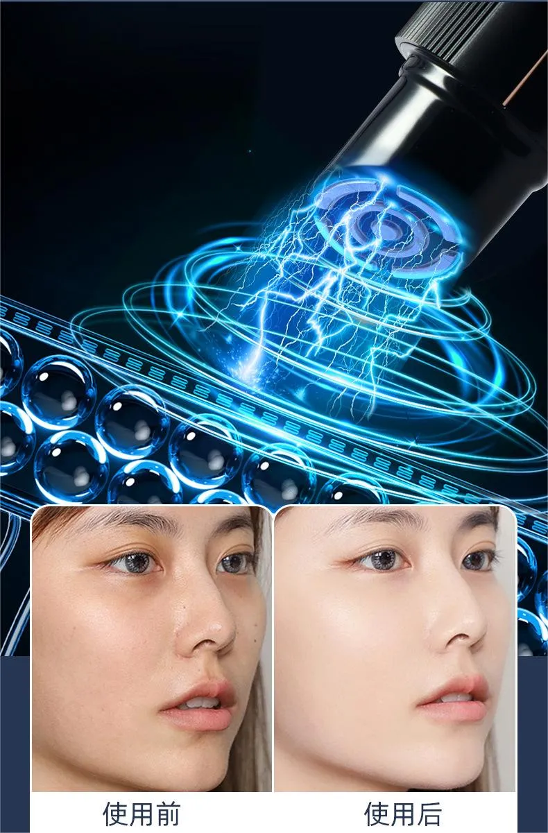Home Use Radio Frequency Eye Cream Massager RF Massage Wand Feature 5
