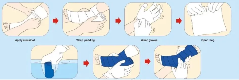 Operation Steps Illustration