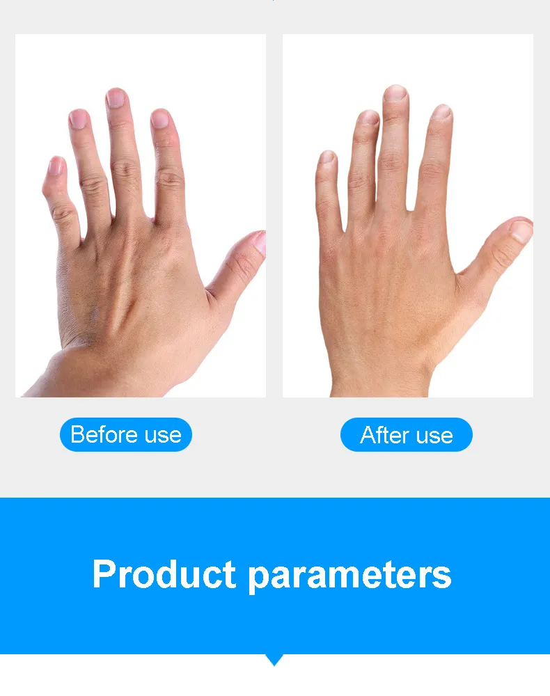 Finger Support Photo 1