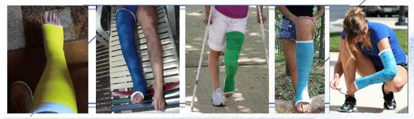 Fiberglass Orthopedic Casting Tape Overview