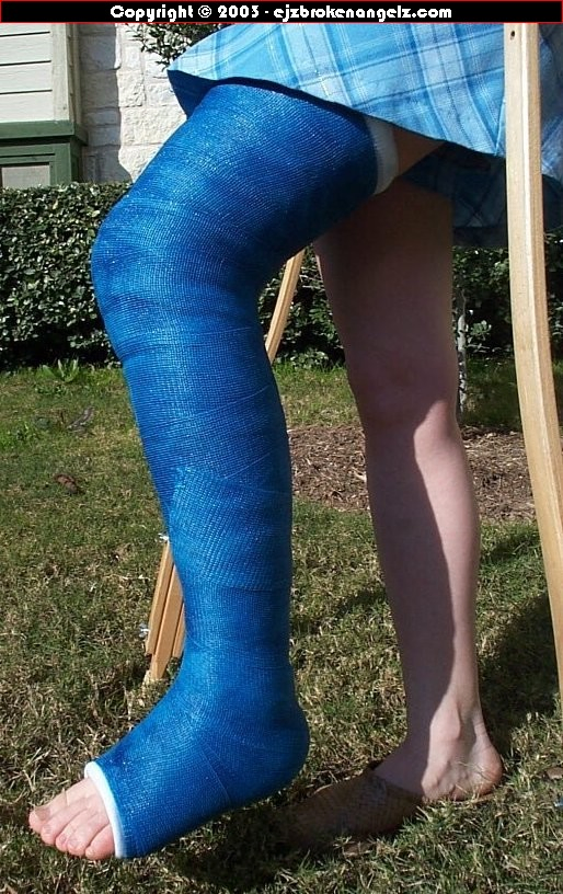 Wholesale Disposable Medical Fiberglass &amp; Orthopedic Casting Tape