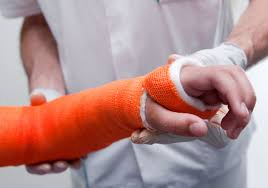 Medical Consumable Water Activated Orthopedic Fiberglass Casting Tape for Medical Orthopedic Support