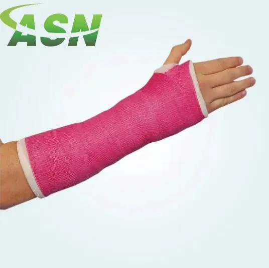 Casting Tape Detail 2