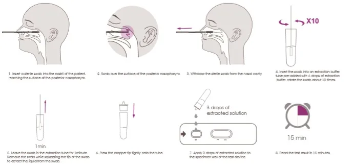 Nasal Swab Procedure