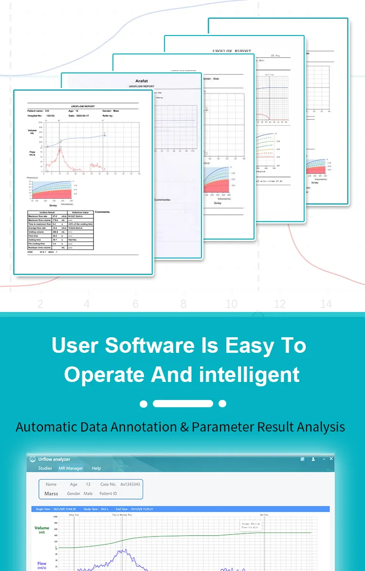 Uroflowmeter System 2