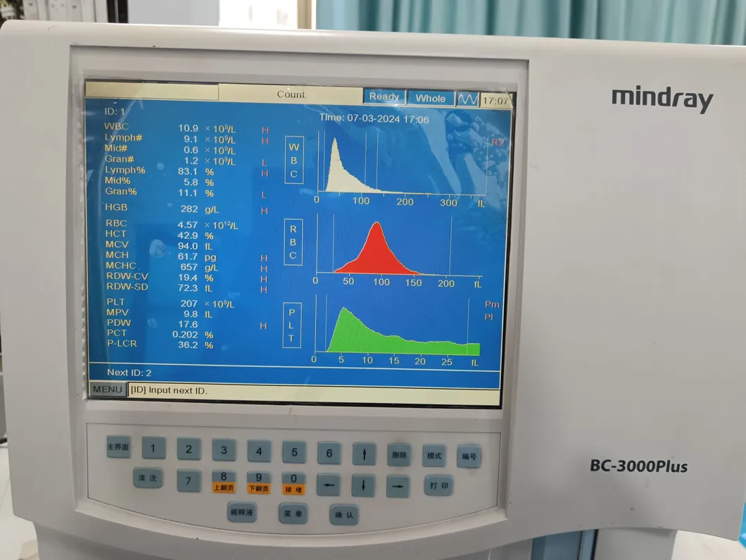 Hematology Analyzer View 2