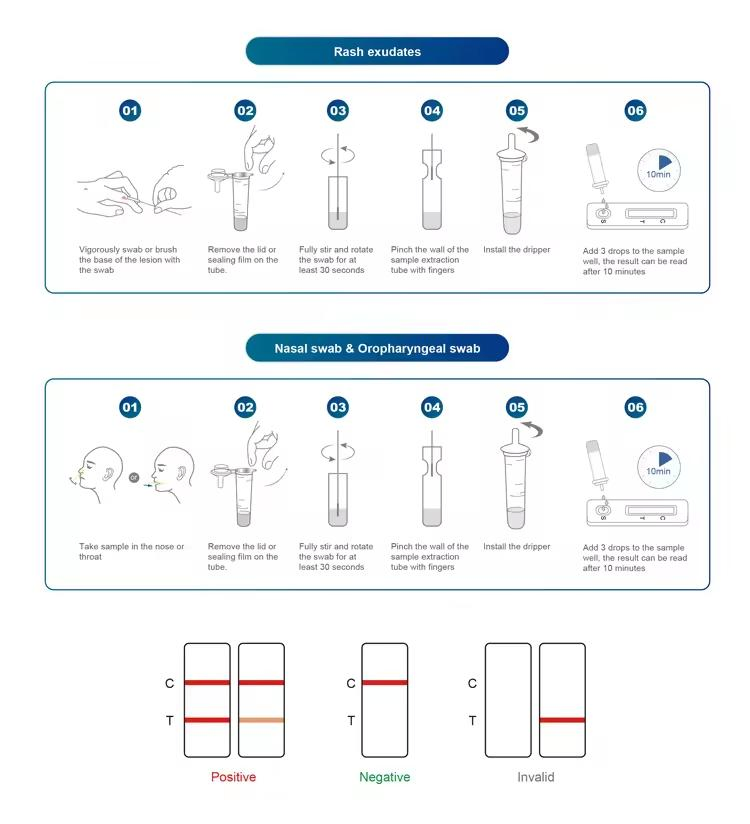 Mpxv Antigen Test Kit Reagent China Rapid Test Fluorescence PCR Diagnostic Kit for Monkeypox Virus
