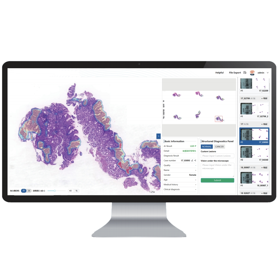 Pathology Ai Diagnosis Equipment Medical Instrument Laboratory Equipment