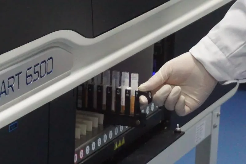 Hospital Fully Auto Enzymatic Chemiluminescence Immunoassay Analyzer System