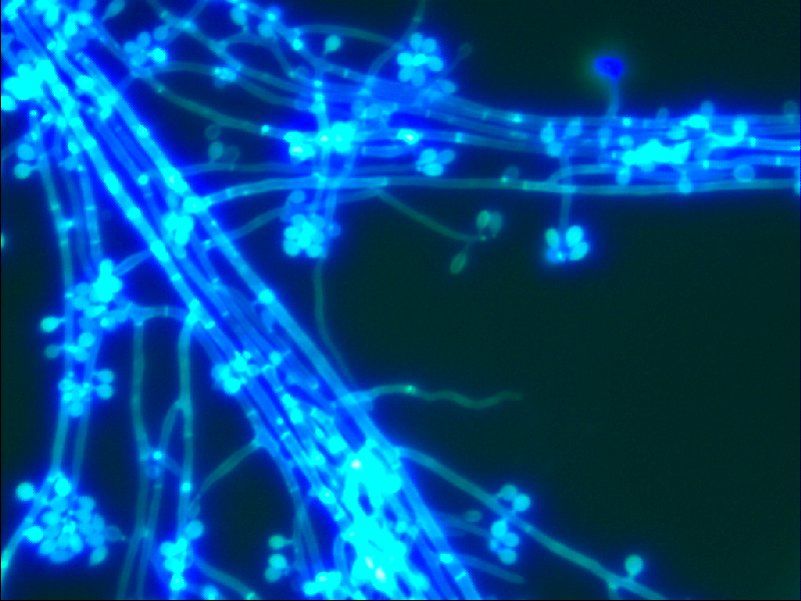 Medomics Fungal Fluorescent Staining Solution