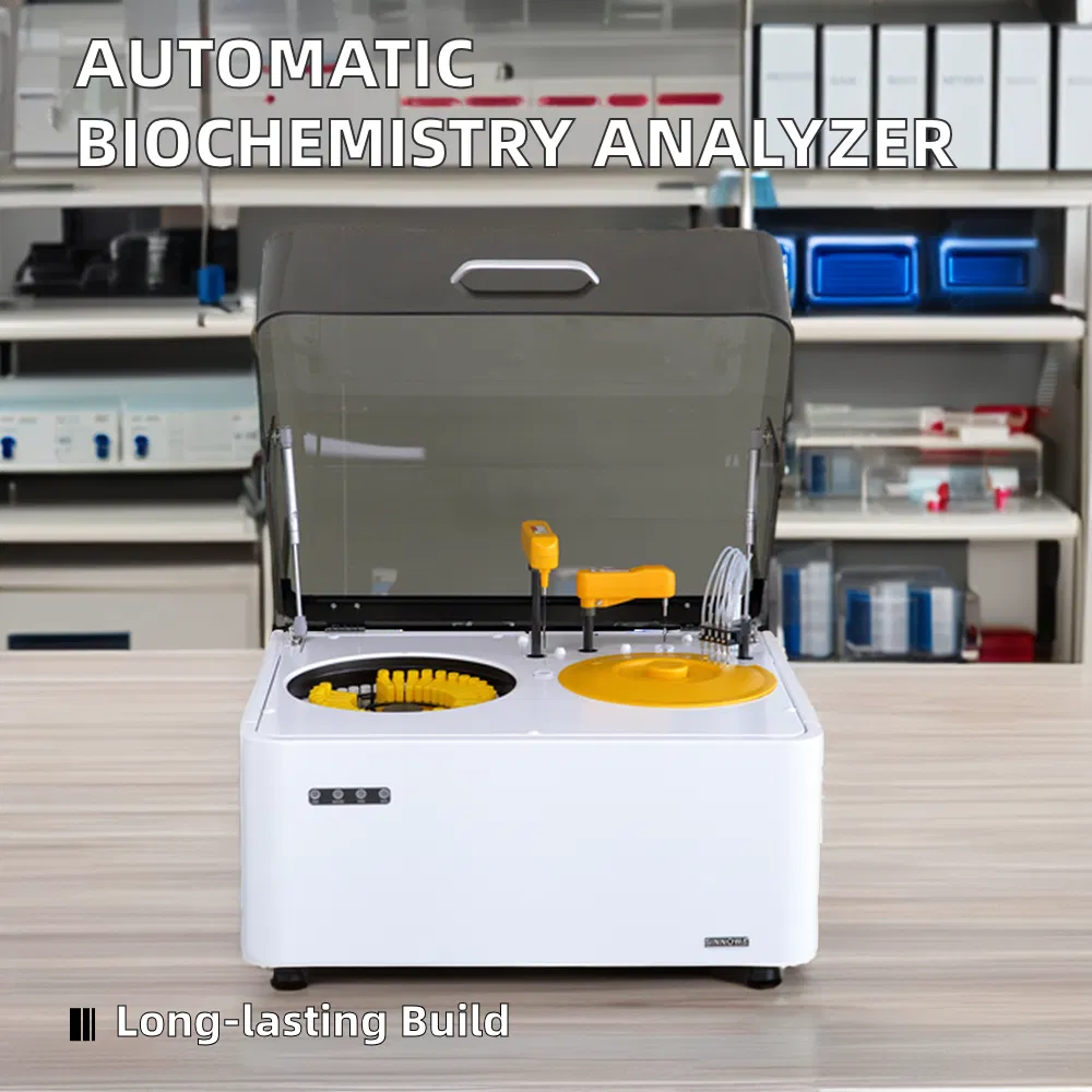 Fully Automatic Hospital Clinic Laboratory Biochemistry Analyzer Urine Analysis System