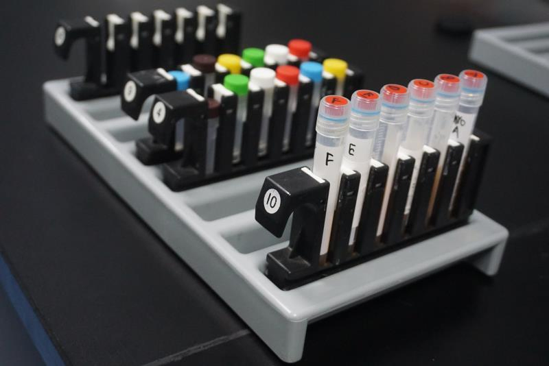 Hospital Fully Auto Enzymatic Chemiluminescence Immunoassay Analyzer System