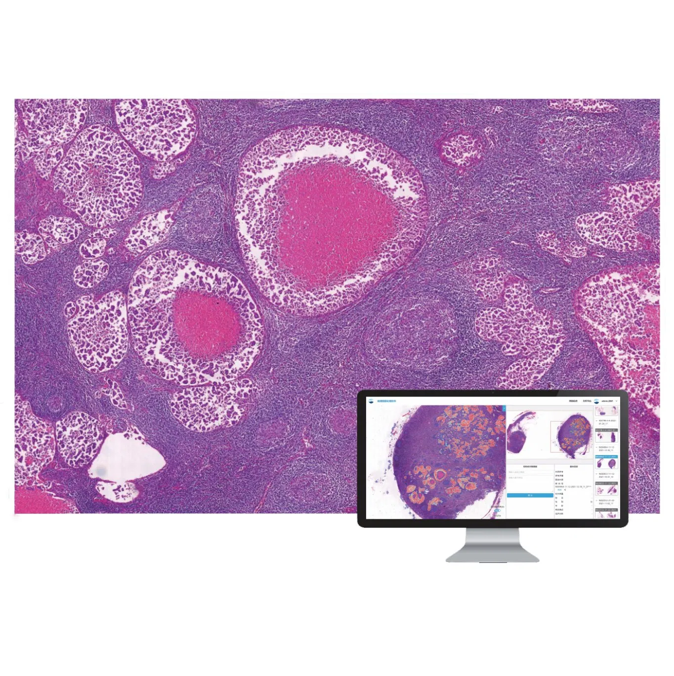 Pathology Ai Diagnosis Equipment Medical Instrument Laboratory Equipment