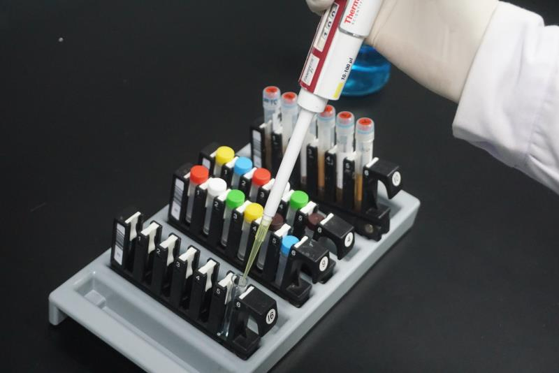 Hospital Fully Auto Enzymatic Chemiluminescence Immunoassay Analyzer System