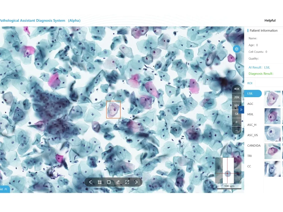 Cervical Cytology