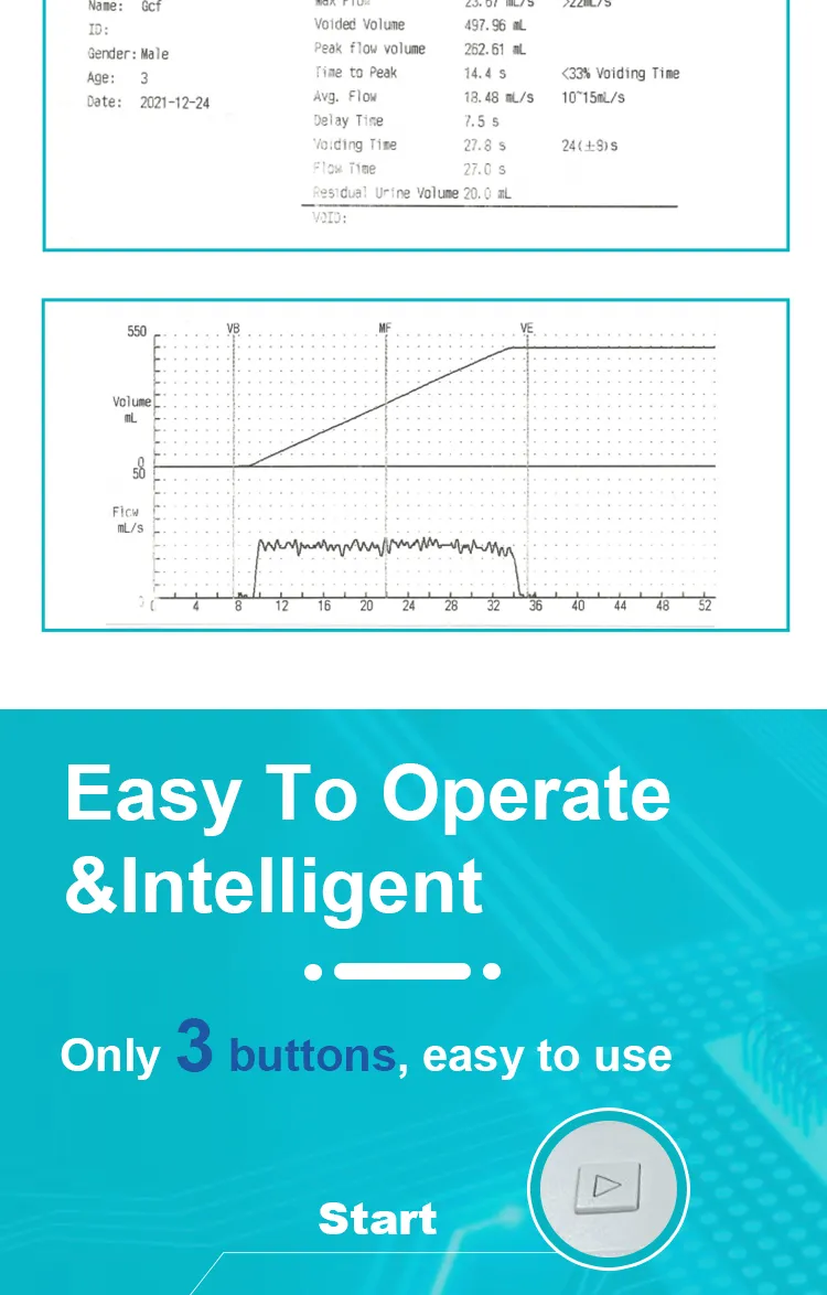 Uroflowmetry System 2