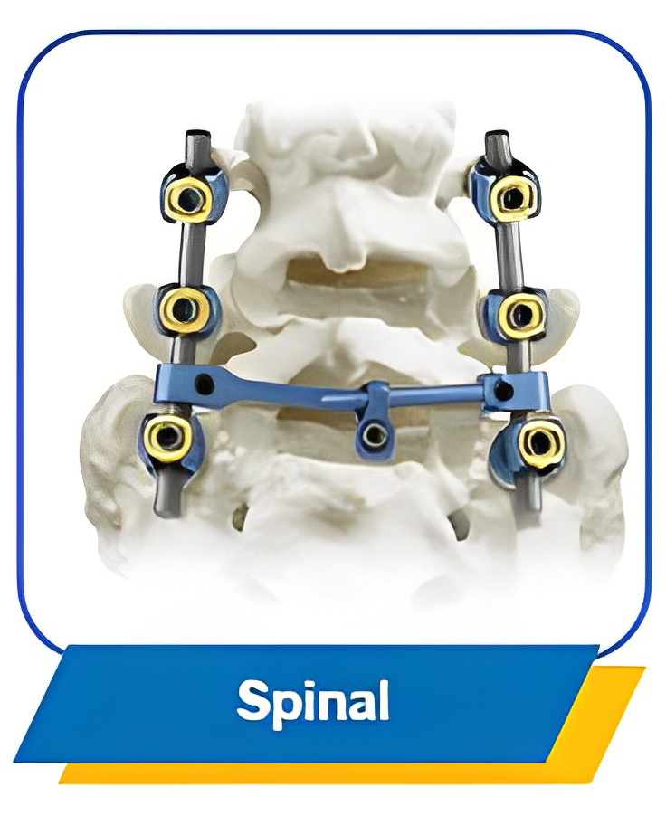 Geasure Ortopedia 6.0 Spinal Polyaxial Pedicle Screw Titanium Alloy Spinal Screw