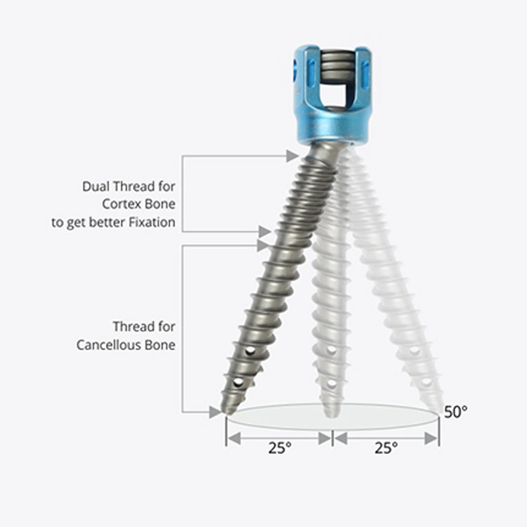 Factory Price 5.5mm Pedicle Screws Spinal Fixation System Titanium Orthopedic Spine Implants for Posterior Fixation