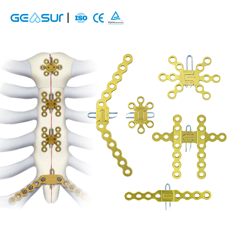 Titanium Alloy Sternal Locking Reconstruction Plate, Straight-type Implant, Surgical Metal Bone Plate, Orthopedic Implant