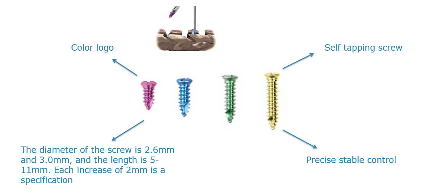 Geasure Low Price Trauma Orthopedics Spine Screws Internal Fixation System Orthopedic Implants Titanium Alloy Dual Thread