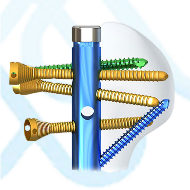 Geasure Ortopedia 5.5 Titanium Polyaxial Spinal Pedicle Screws Orthopedic Spinal Implant Hospital Use Interventional Materials
