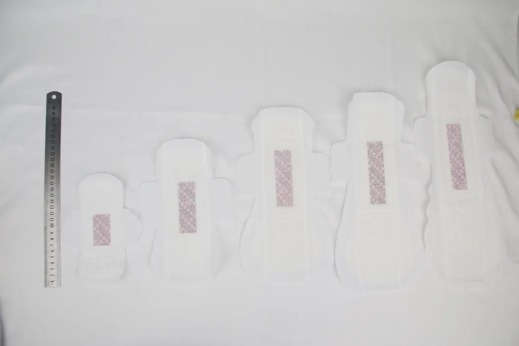 Distribución 1