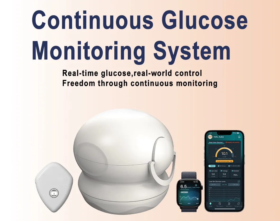 Continuous Glucose Monitor 1
