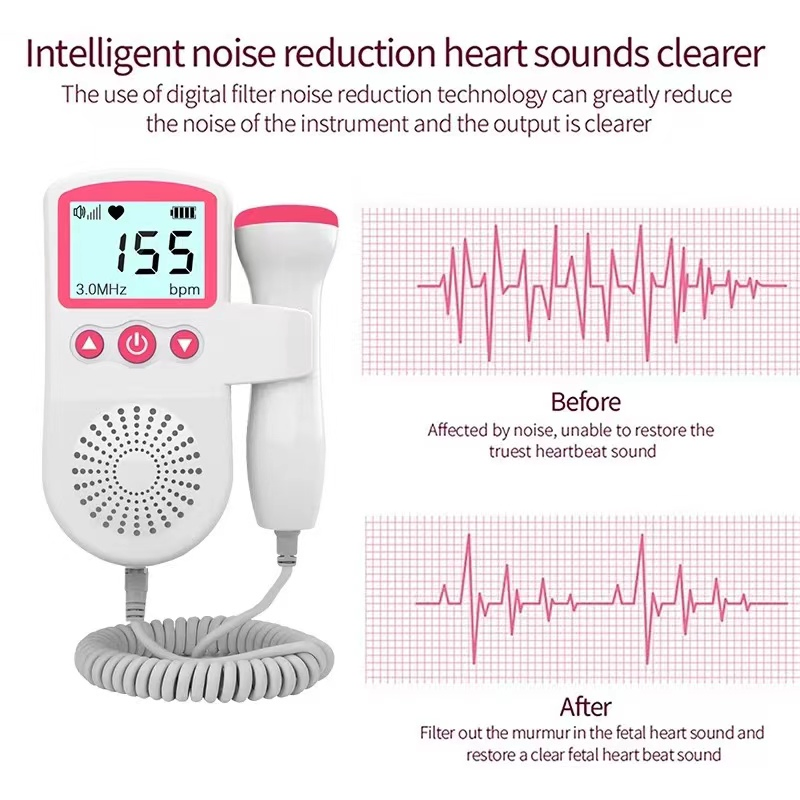 Home Care Fetal Heart Rate Monitor Baby Heart Rate Doppler