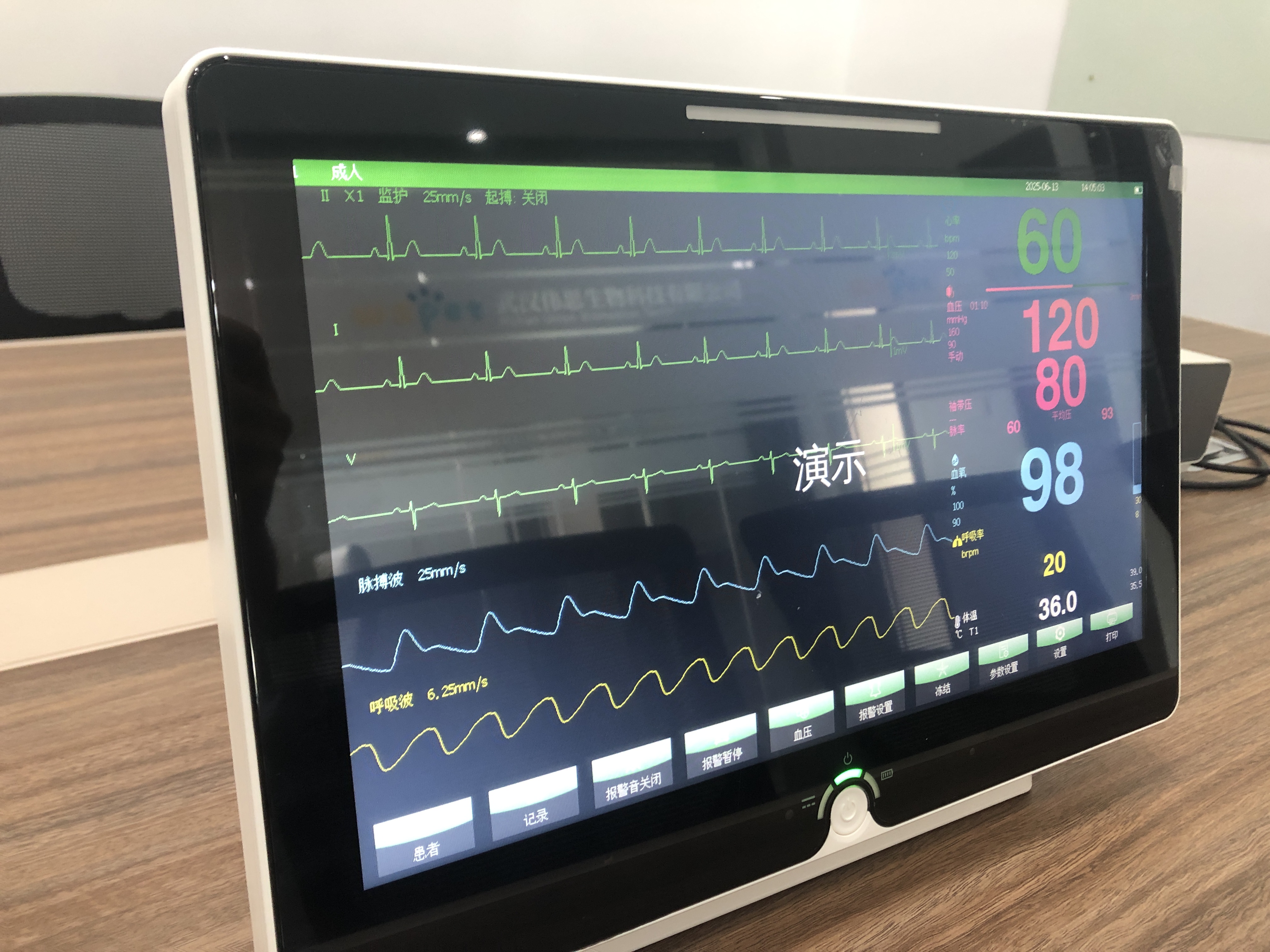 Veterinary Patient Monitor With Touchscreen Interface And Multi Parameter Vital Sign Monitoring For Clinical Monitoring