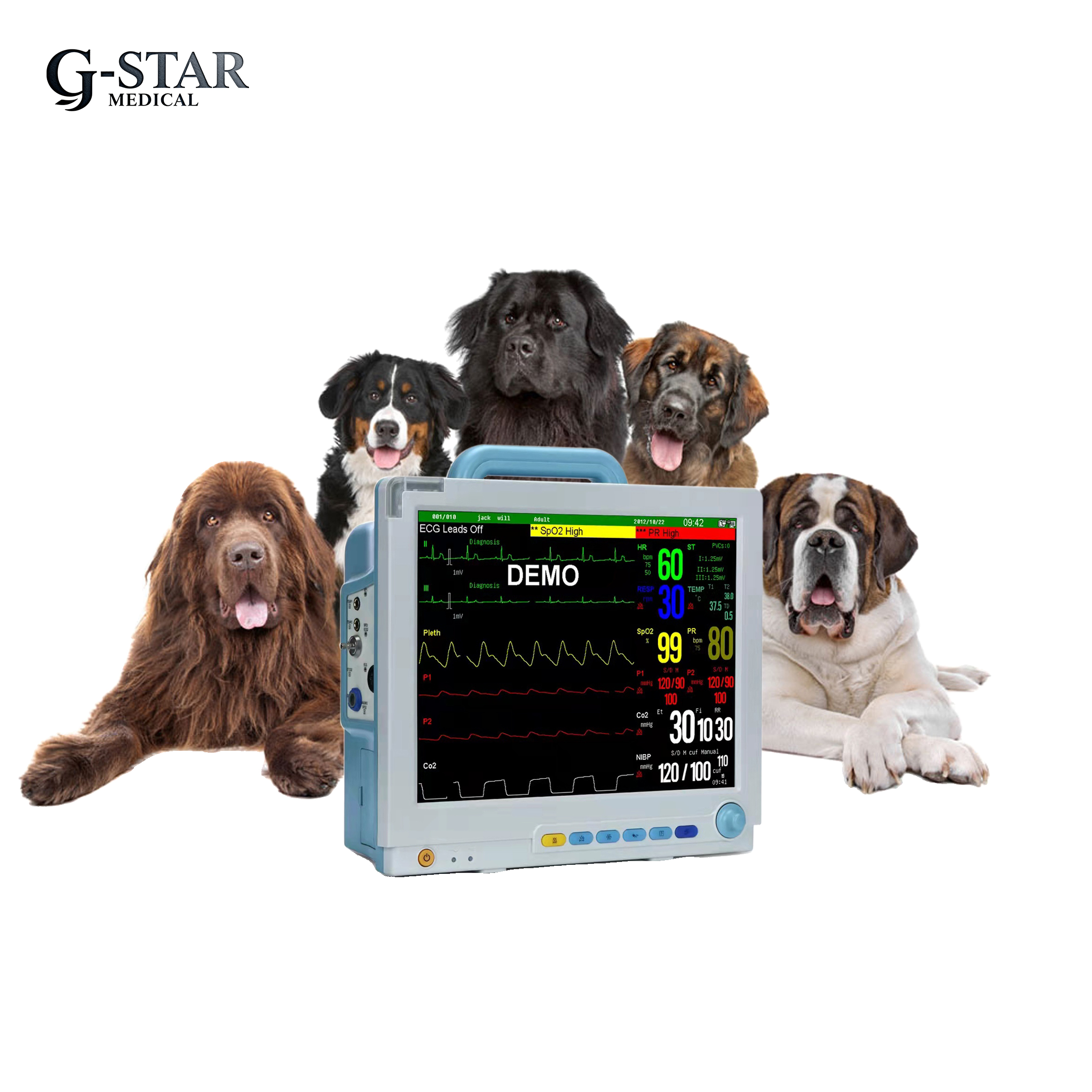Medical Equipment Portable 15 Inch Multi-Parameter Patient Monitor for ICU &amp; Veterinary Use