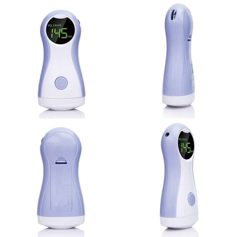 Fetal Doppler Display