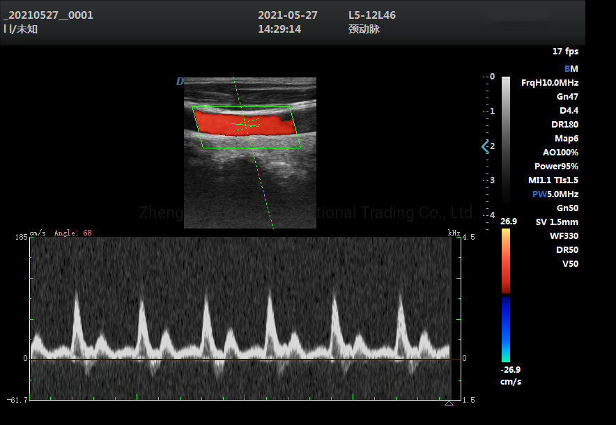 China Portable Win8 System Laptop 4D/5D Fetal Color Doppler with CE