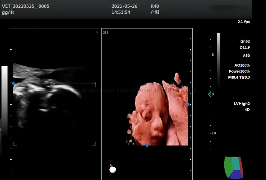 Laptop 4D Color Doppler