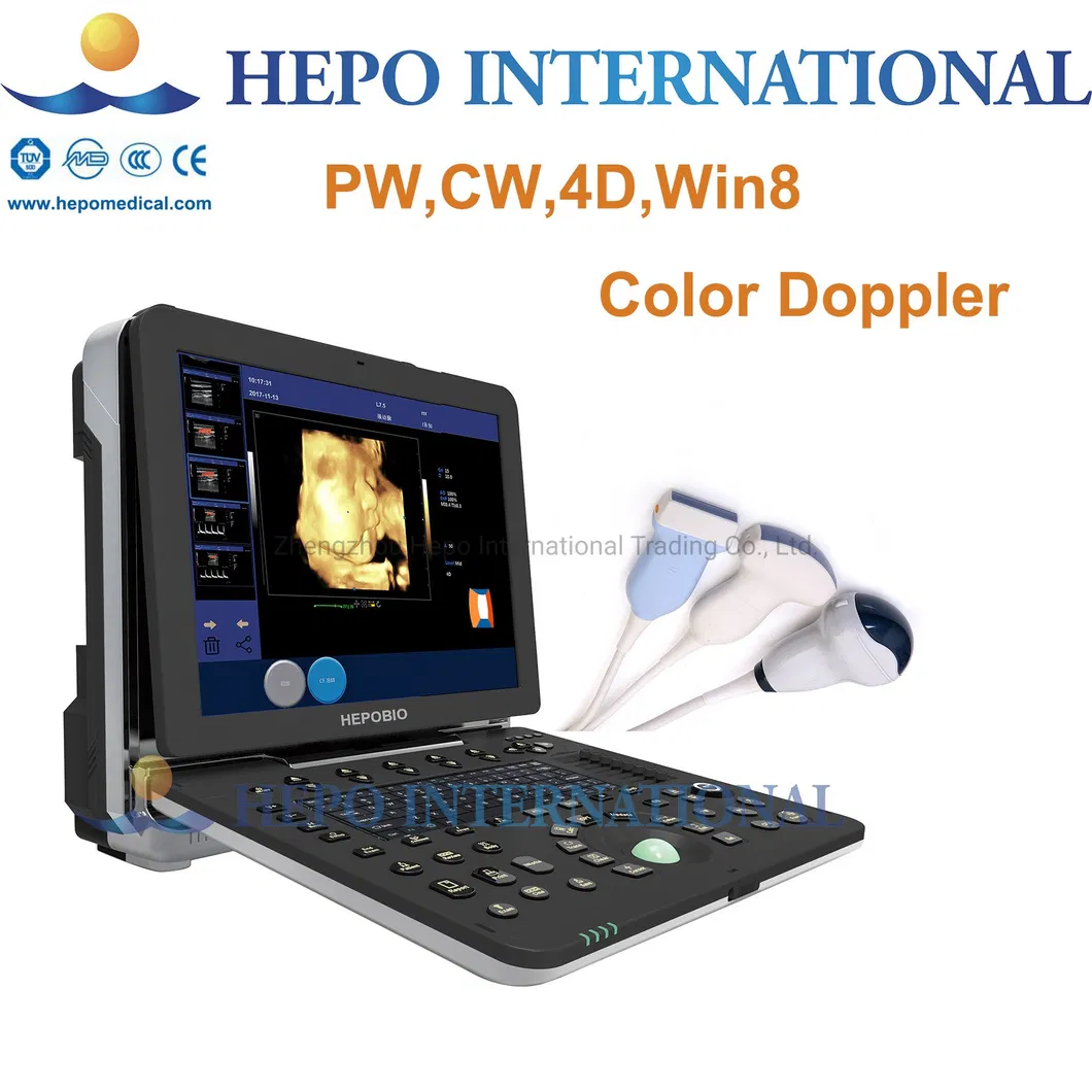 Cardiac Doppler
