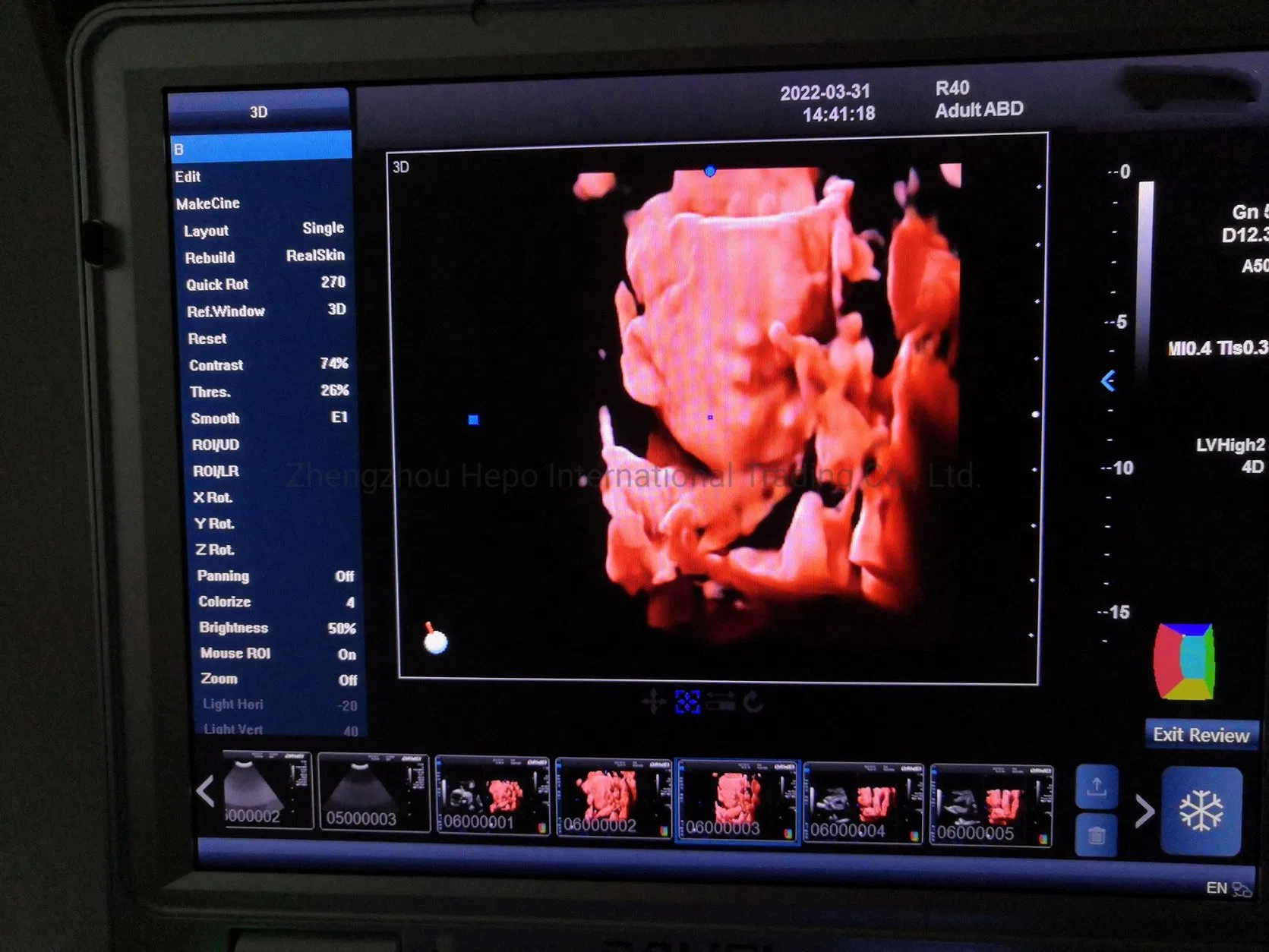 China Portable Win8 System Laptop 4D/5D Fetal Color Doppler with CE