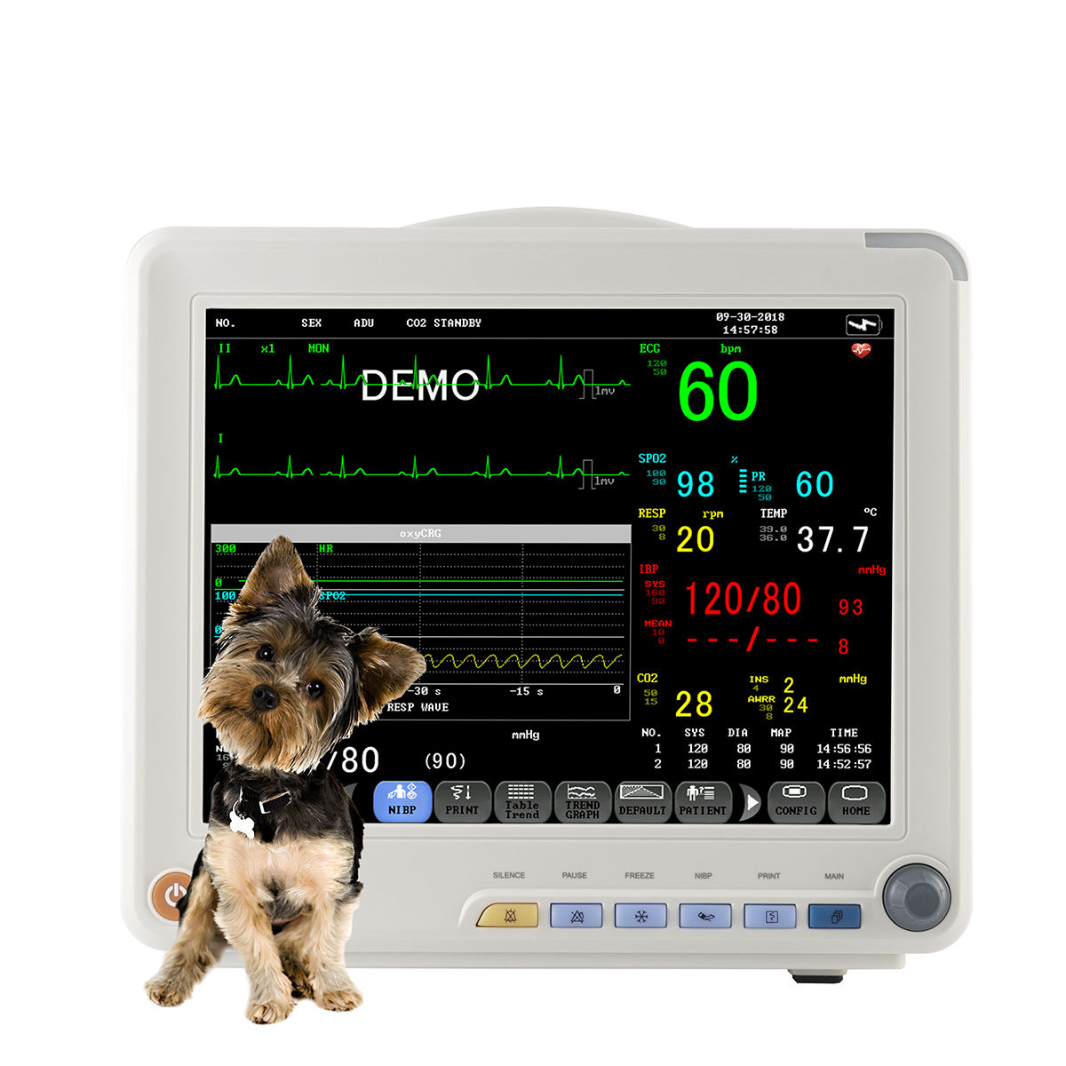 Veterinary Multi Parameter Patient Monitor with ECG SpO2 NIBP TEMP RESP for Animal ICU Hospital