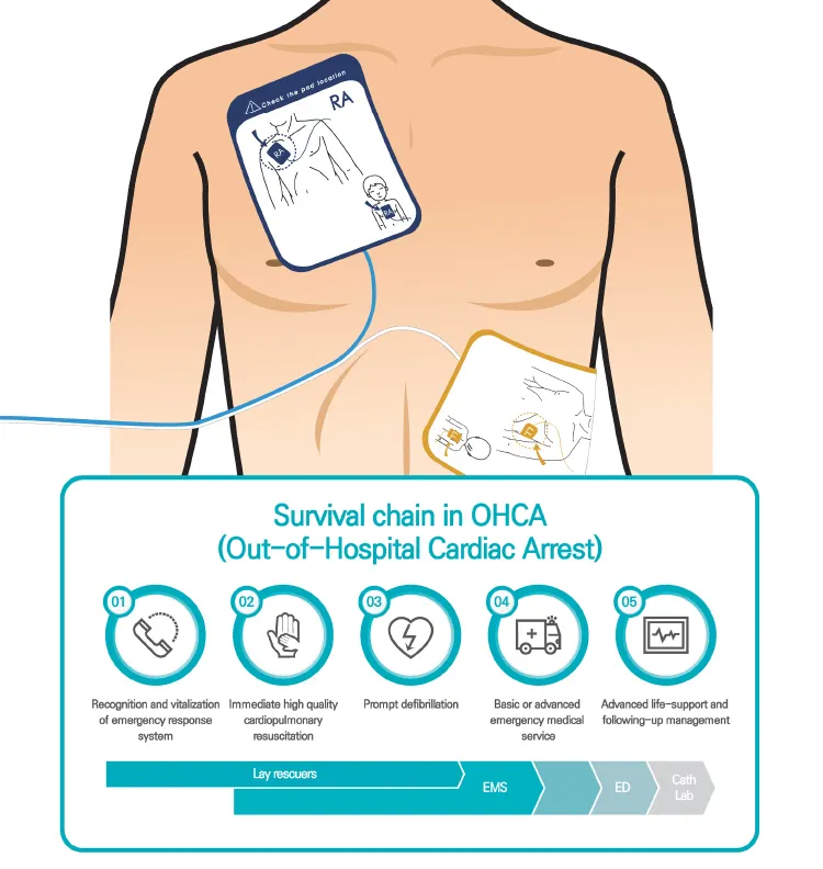 AED Description Image 4