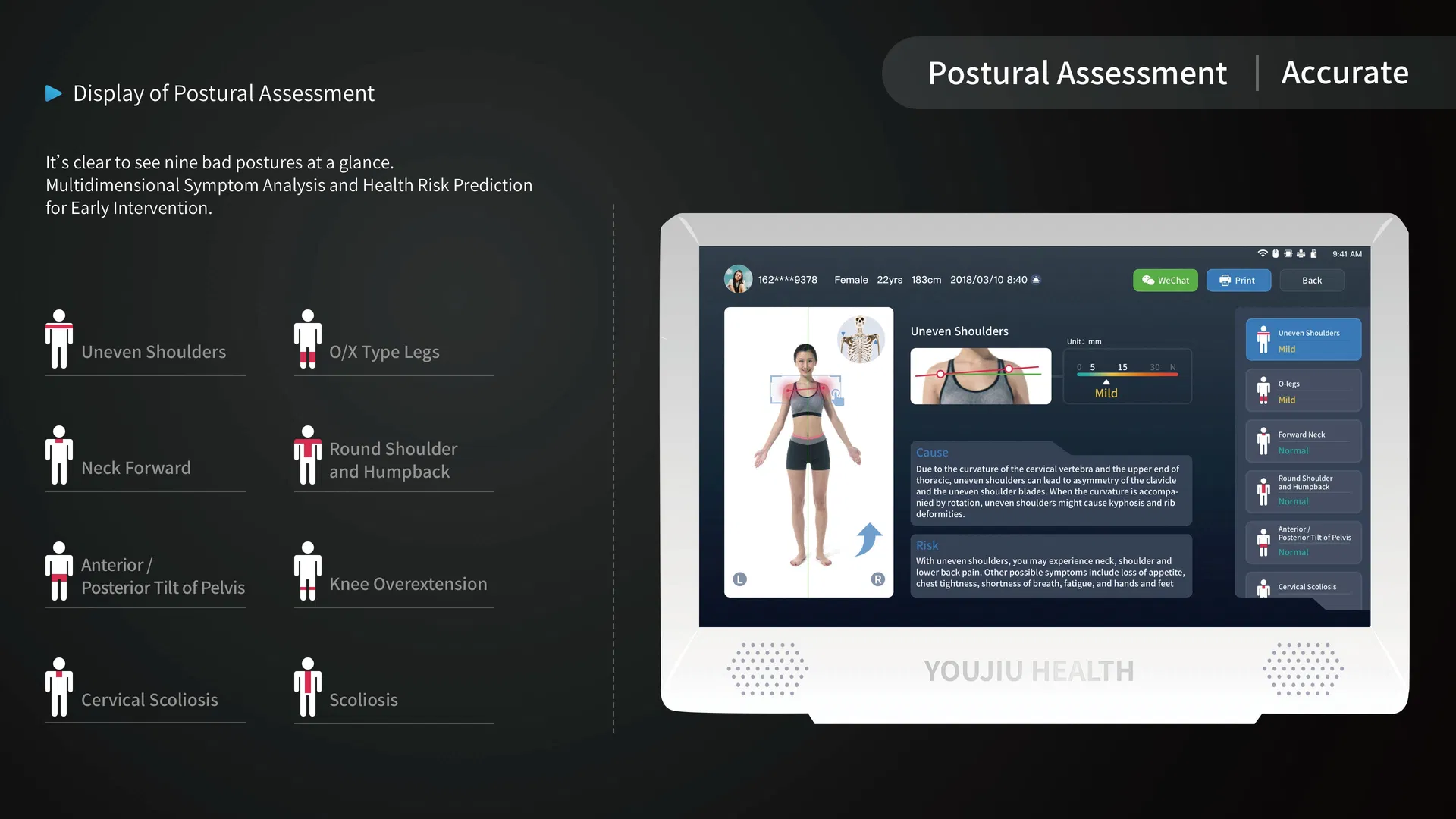 Body Composition Analyzer Display 4