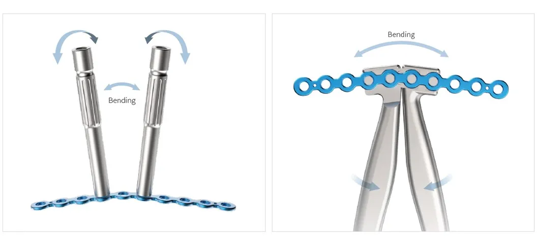 Trauma Plate System 2