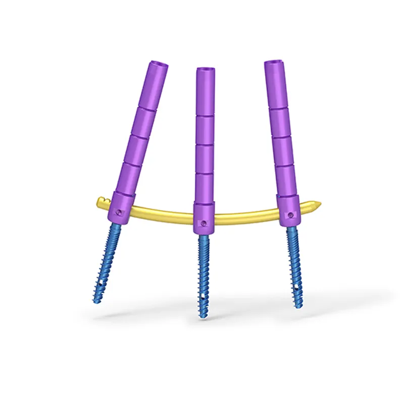 Spine System Detail 1