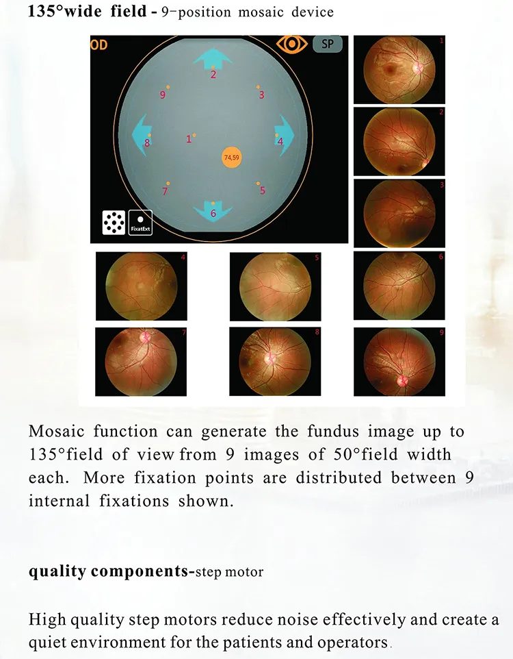 Fundus Camera View 5