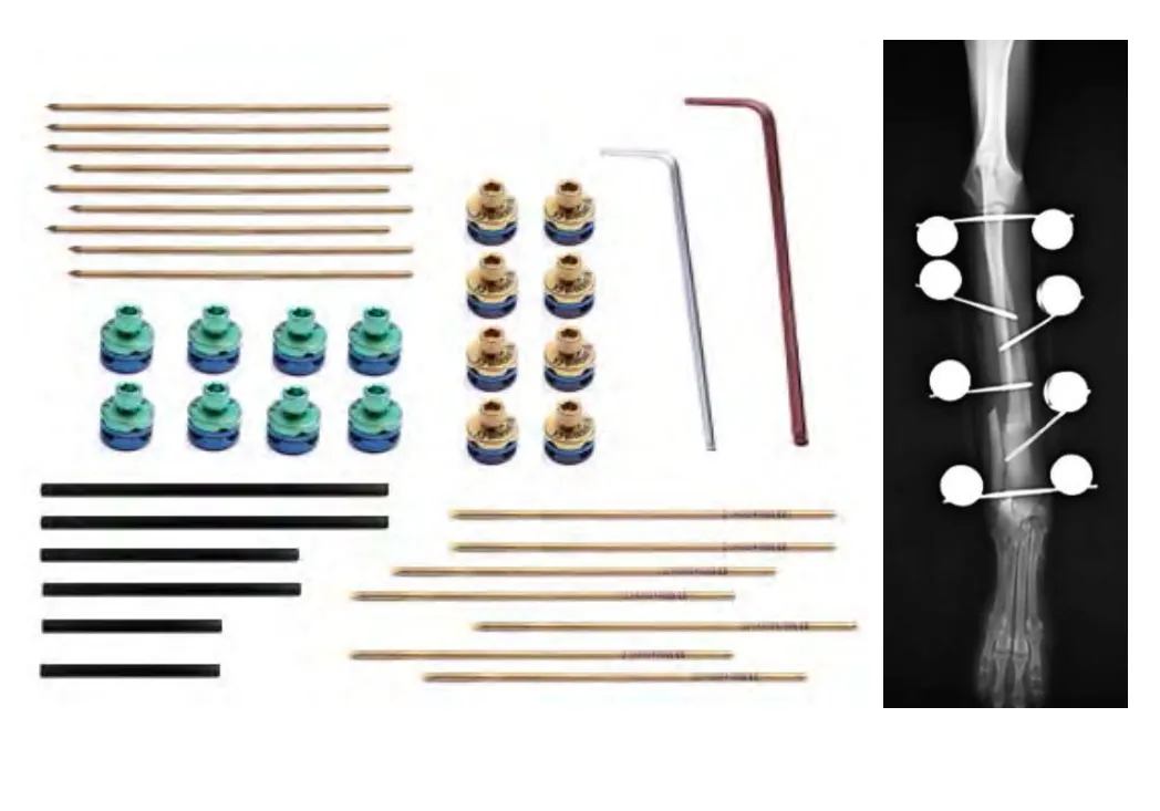 Mini External Fixation System 3