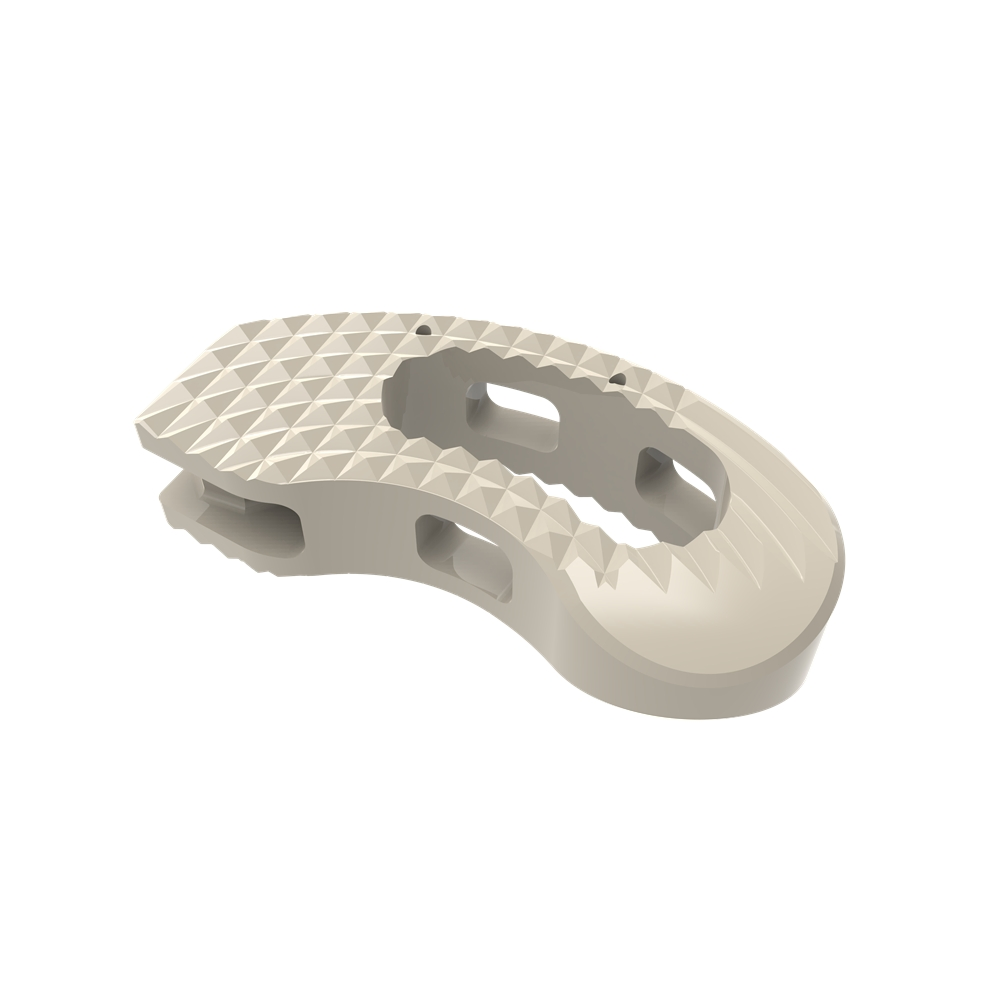 Advanced Lumbar Fusion Cage Mimicking Cortical Bone Strength