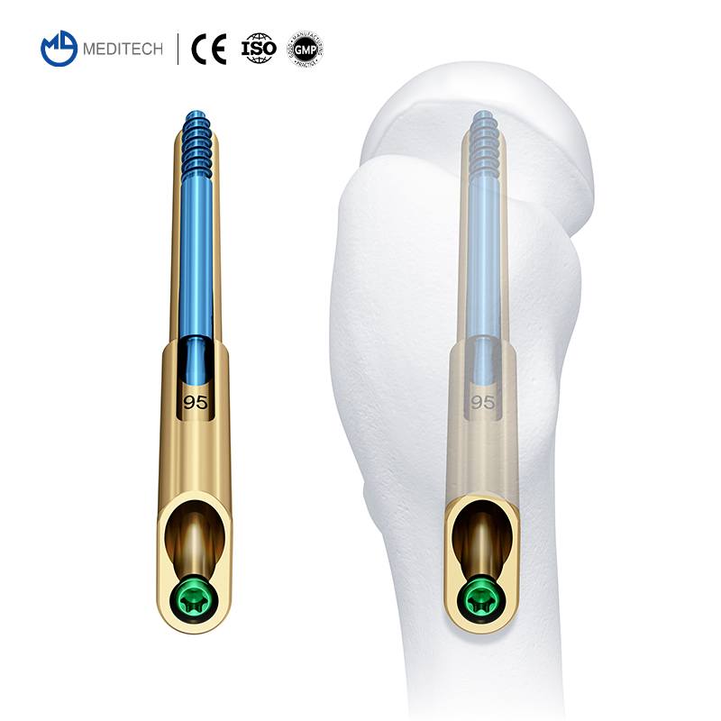 Orthopedic Locking Plates and Screws Femoral Neck Dynamic Cross Screw System