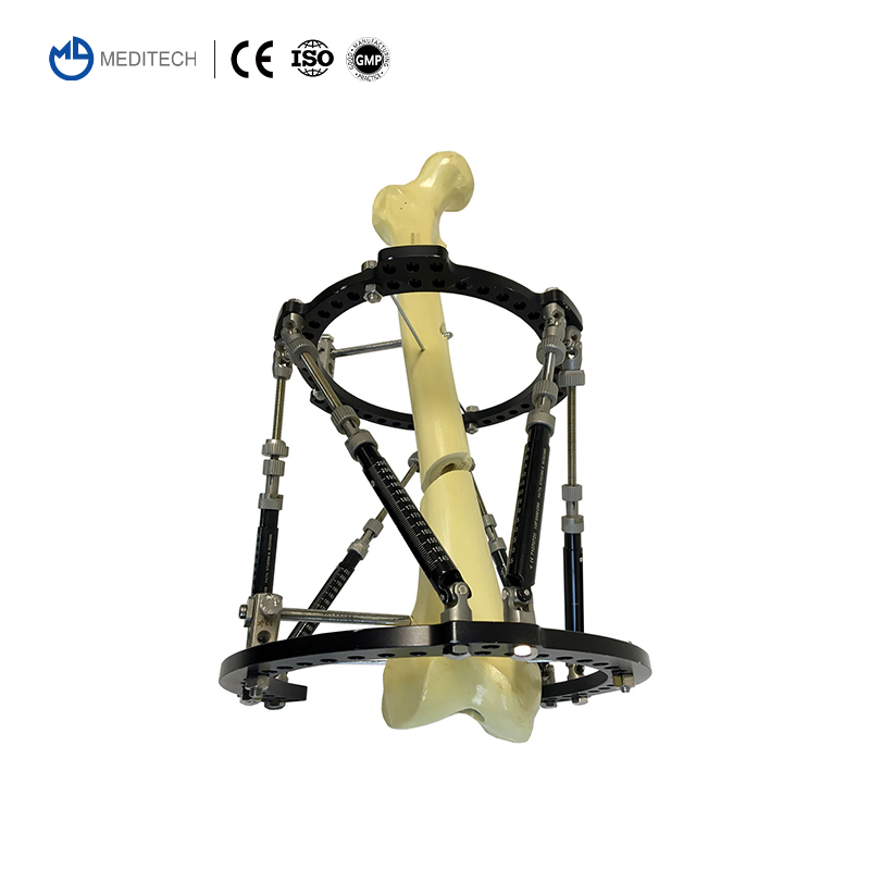 External Fixator Orthopedic Instruments Ilizarov Fixation System Lower Limb Lengthening